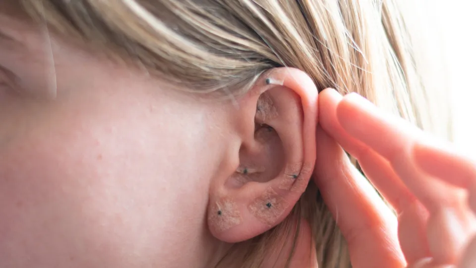 A orelha, um mapa secreto do corpo e da cura