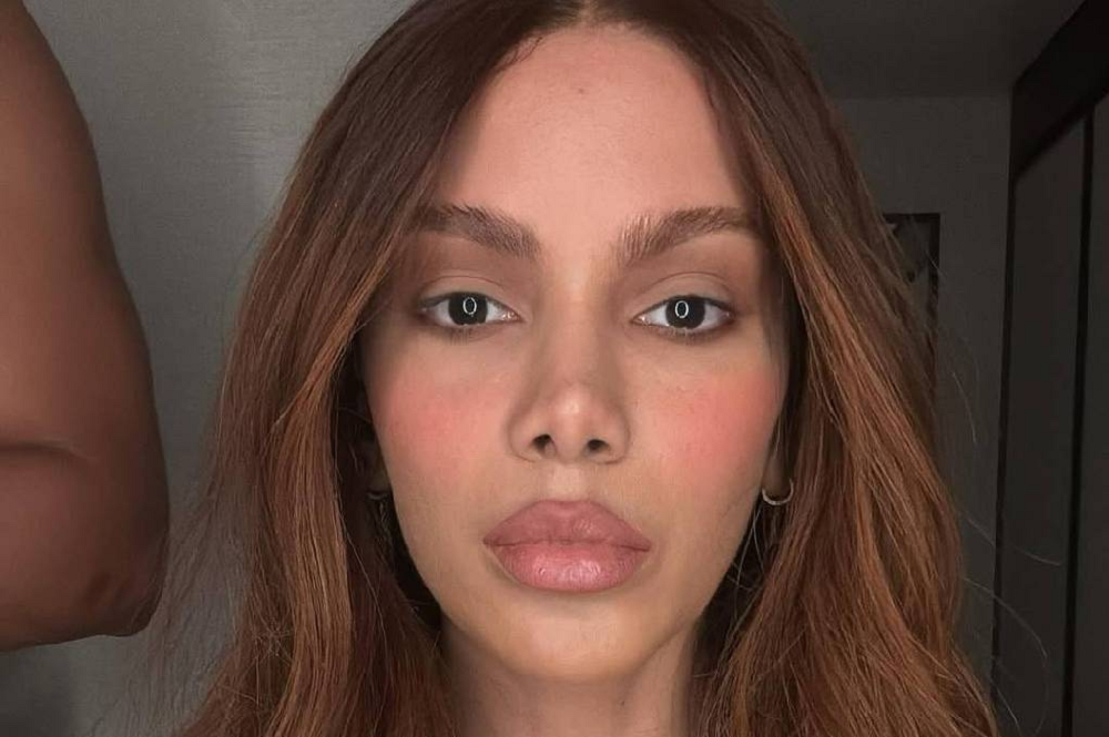 Anitta fala pela primeira vez sobre novos procedimentos estéticos: ‘O corpo é meu’