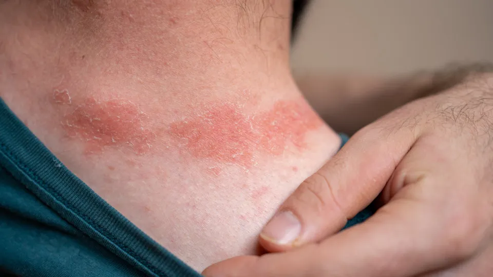 Coisas inesperadas que podem ser alérgicas e você não sabia