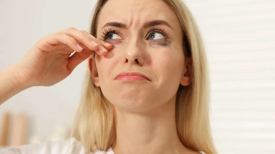 Cílios fracos ou ralos? Veja causas e como fortalecê-los